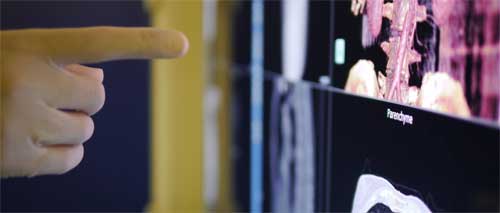 Therapixel : 600 k€ pour l'entrée du digital au bloc opératoire
